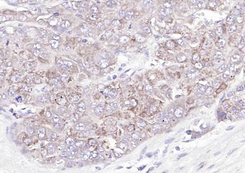 FAM134B Rabbit Polyclonal Antibody