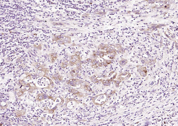 TFRC Rabbit Polyclonal Antibody