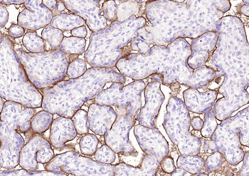 TFRC Rabbit Polyclonal Antibody