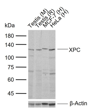 XPC Rabbit Polyclonal Antibody