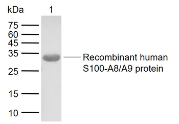 MRP8+MRP14 Rabbit Polyclonal Antibody