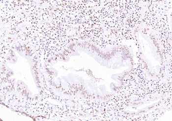 ERK1 Mouse Monoclonal Antibody