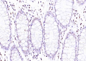 ERK1 Mouse Monoclonal Antibody