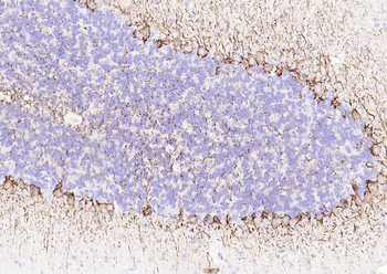 NF-L Rabbit Polyclonal Antibody