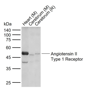 Angiotensin II Type 1 Receptor Rabbit Polyclonal Antibody