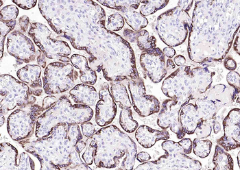Human CGA Mouse Monoclonal Antibody