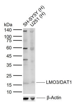 LMO3/DAT1 Rabbit Polyclonal Antibody