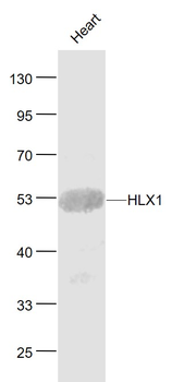 HLX1 Rabbit Polyclonal Antibody