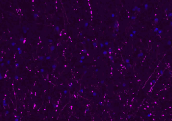 Donkey Anti-Rabbit IgG H&L, BF647 conjugated