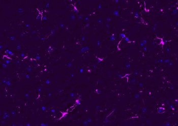 Donkey Anti-Rabbit IgG H&L, BF647 conjugated