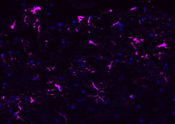 Donkey Anti-Rabbit IgG H&L, BF647 conjugated