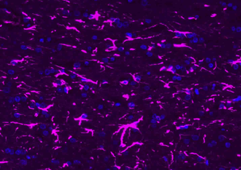 Donkey Anti-Rabbit IgG H&L, BF647 conjugated