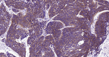 Human FASN Ready-To-Use IHC Kit