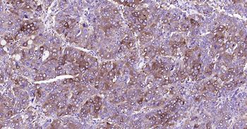 Human FASN Ready-To-Use IHC Kit