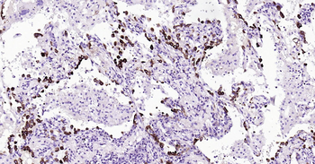 Human FASN Ready-To-Use IHC Kit