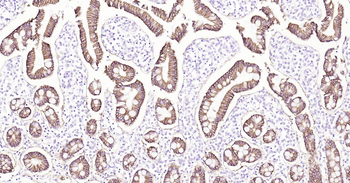 ATP1A1 Ready-To-Use IHC Kit