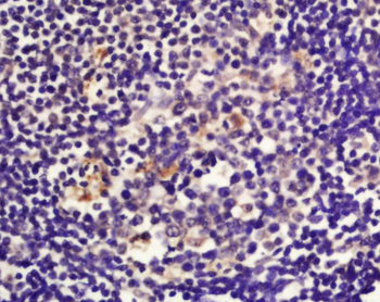 TAP1 Rabbit Polyclonal Antibody