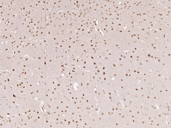 Phospho-AMPK alpha 1 (Thr183) + AMPK alpha 2 (Thr172) Rabbit Polyclonal Antibody