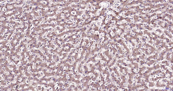 ARL6 Rabbit Polyclonal Antibody
