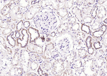 ATG14 Rabbit Polyclonal Antibody