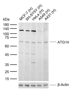 ATG14 Rabbit Polyclonal Antibody