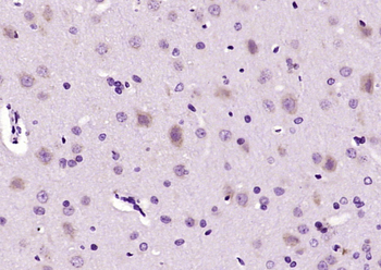 ACTG1 Rabbit Polyclonal Antibody