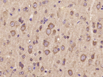 AKT2 Rabbit Polyclonal Antibody