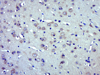 Phospho-BACE1 (Ser498) Rabbit Polyclonal Antibody
