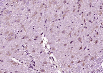 Hrk Rabbit Polyclonal Antibody