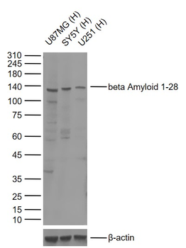 Beta Amyloid 1-28 Rabbit Polyclonal Antibody