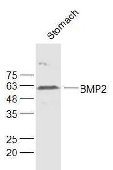 BMP2 Rabbit Polyclonal Antibody