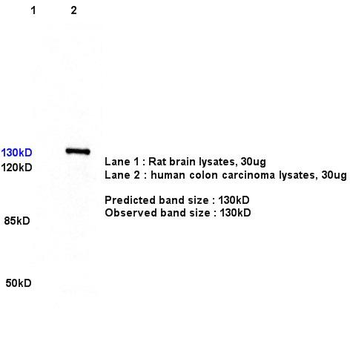 CD163 Rabbit Polyclonal Antibody