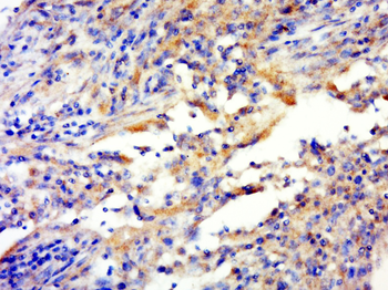 C1orf158 Rabbit Polyclonal Antibody