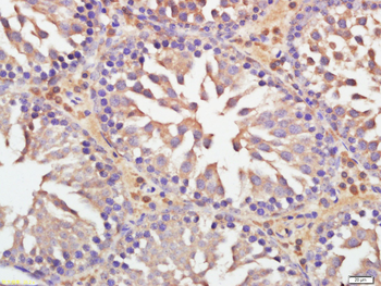 C19orf51 Rabbit Polyclonal Antibody