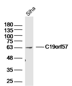 C19orf57 Rabbit Polyclonal Antibody