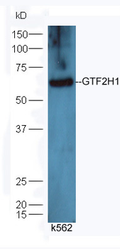 GTF2H1 Rabbit Polyclonal Antibody