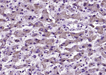 ANGPTL8 Rabbit Polyclonal Antibody