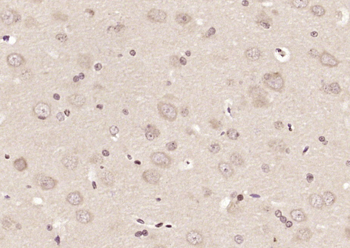 C1D Rabbit Polyclonal Antibody