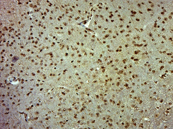 CCDC62 Rabbit Polyclonal Antibody
