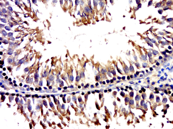 CCDC73 Rabbit Polyclonal Antibody