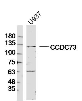 CCDC73 Rabbit Polyclonal Antibody