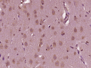 CENPL Rabbit Polyclonal Antibody
