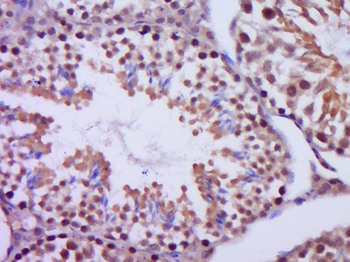 Centrin 2 Rabbit Polyclonal Antibody