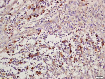 CEP120 Rabbit Polyclonal Antibody