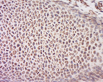 CEP70 Rabbit Polyclonal Antibody