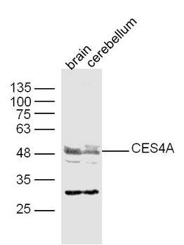 CES4A Rabbit Polyclonal Antibody