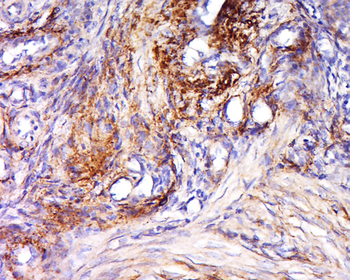 CES4A Rabbit Polyclonal Antibody
