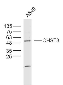 CHST3 Rabbit Polyclonal Antibody