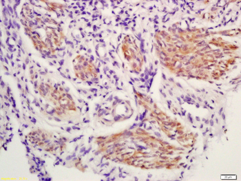 Cyclooxygenase 2 Rabbit Polyclonal Antibody