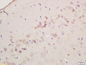 Cyclooxygenase 2 Rabbit Polyclonal Antibody